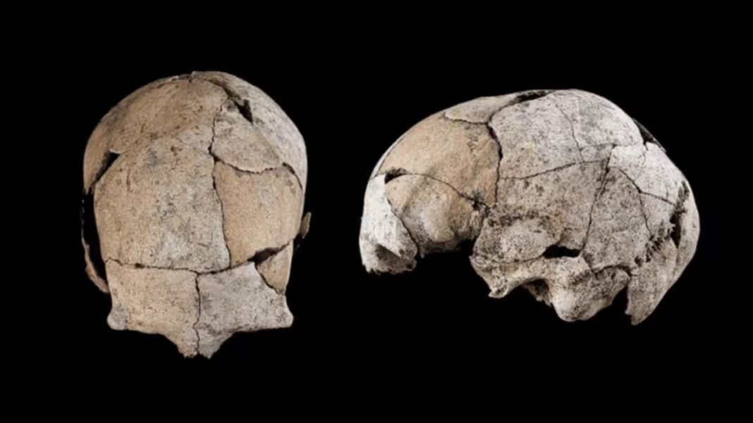 Buried for 5,300 years beneath a Stone Age tomb, a skull discovered in Spain has revealed the world’s earliest known ear surgery | Buried for 5,300 years beneath a Stone Age tomb, a skull discovered in Spain has revealed the world’s earliest known ear surgery |