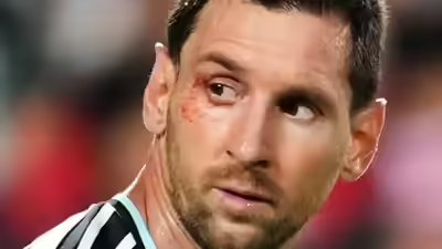 No easy wins in FIFA World Cup: Lionel Scaloni says ‘suffering part of our DNA’ as Argentina survive Switzerland scare | Football News No easy wins in FIFA World Cup: Lionel Scaloni says ‘suffering part of our DNA’ as Argentina survive Switzerland scare | Football News