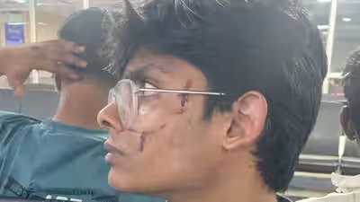 IP University PRO’s son allegedly attacked by neighbours in Dwarka, FIR not registered yet IP University PRO’s son allegedly attacked by neighbours in Dwarka, FIR not registered yet