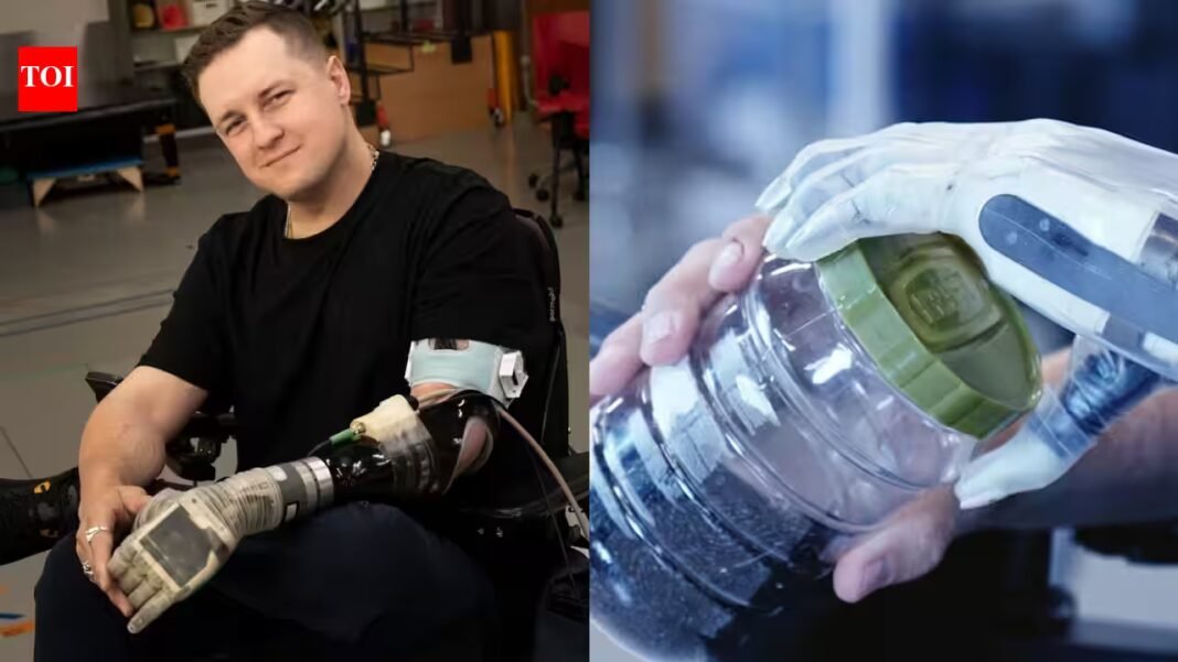 A Florida man lost his left arm after a 35-foot fall at 16; 17 years later, he is the first to take home a thought-controlled bionic arm that can restore his sense of touch A Florida man lost his left arm after a 35-foot fall at 16; 17 years later, he is the first to take home a thought-controlled bionic arm that can restore his sense of touch