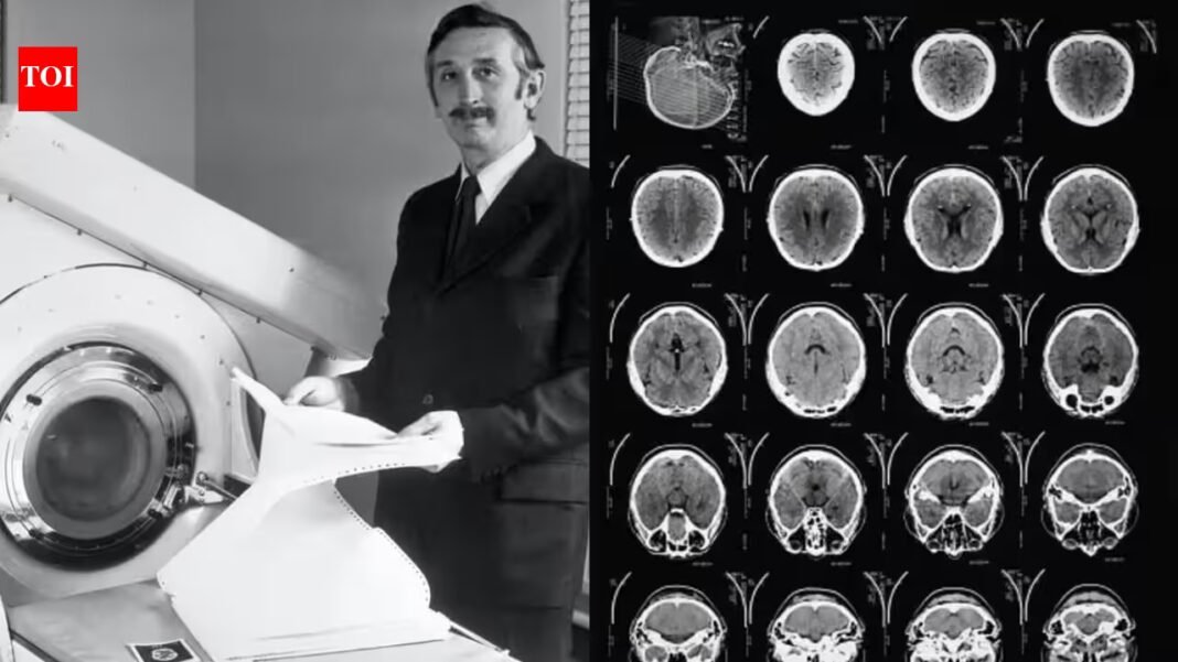 In 1971, engineer Godfrey Hounsfield’s new scanner revealed a brain cyst in the first clinical CT scan; 8 years later, he shared the Nobel Prize for developing computer-assisted tomography In 1971, engineer Godfrey Hounsfield’s new scanner revealed a brain cyst in the first clinical CT scan; 8 years later, he shared the Nobel Prize for developing computer-assisted tomography